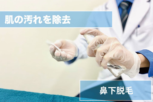 鼻下ヒゲ脱毛Step3