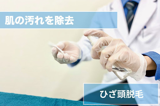 ひざ頭脱毛Step3