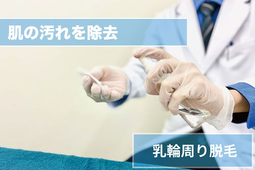 乳輪周り脱毛Step3