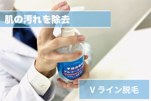 Vライン脱毛Step3